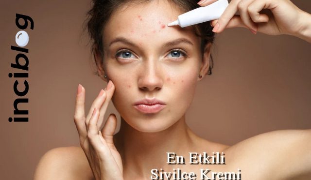 en etkili sivilce kremi, en iyi sivilce kremi, dermatologların önerdiği sivilce kremi, en etkili sivilce kremi eczane