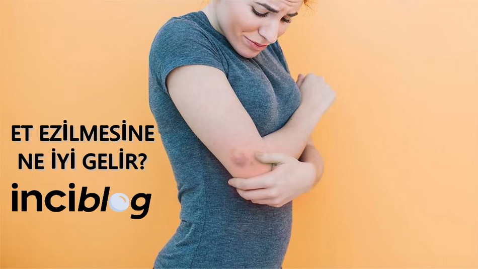 et ezilmesine ne iyi gelir, et ezilmesi belirtileri, et ezilmesi kaç günde iyileşir