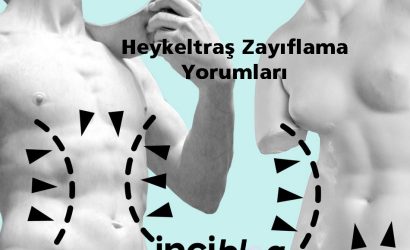 heykeltraş zayıflama yaptiranlar yorumları , heykeltraş zayıflama nedir , heykeltraş zayıflama yaptiranlar , heykeltraş zayıflama zararları
