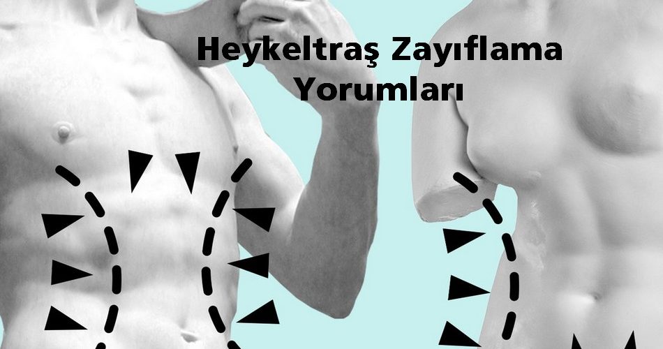 heykeltraş zayıflama yaptiranlar yorumları , heykeltraş zayıflama nedir , heykeltraş zayıflama yaptiranlar , heykeltraş zayıflama zararları