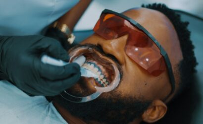 Erkekler Neden Diş Teli Sever?